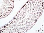 ERCC1 Antibody in Immunohistochemistry (Paraffin) (IHC (P))