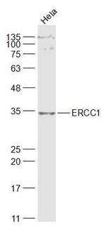 ERCC1 Antibody in Western Blot (WB)