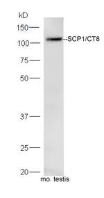 SCP1 Antibody in Western Blot (WB)