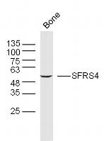 SFRS4 Antibody in Western Blot (WB)