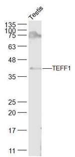 TEFF1 Antibody in Western Blot (WB)