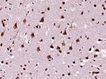 hnRNP DL Antibody in Immunohistochemistry (Paraffin) (IHC (P))