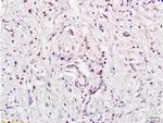 E2F5 Antibody in Immunohistochemistry (Paraffin) (IHC (P))