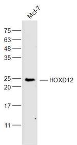 HOXD12 Antibody in Western Blot (WB)