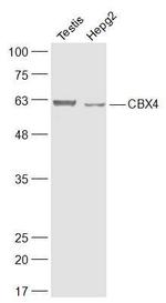 CBX4 Antibody in Western Blot (WB)