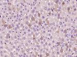 HPS5 Antibody in Immunohistochemistry (Paraffin) (IHC (P))