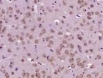 HPS5 Antibody in Immunohistochemistry (Paraffin) (IHC (P))