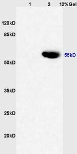 CYP3A4 Antibody in Western Blot (WB)