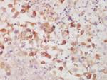 CK7 Antibody in Immunohistochemistry (Paraffin) (IHC (P))
