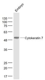 CK7 Antibody in Western Blot (WB)