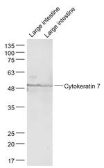 CK7 Antibody in Western Blot (WB)