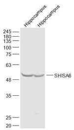 SHISA6 Antibody in Western Blot (WB)