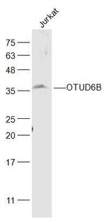 OTUD6B Antibody in Western Blot (WB)