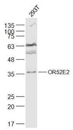 OR52E2 Antibody in Western Blot (WB)