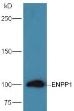 ENPP1/PC1/3 Antibody in Western Blot (WB)