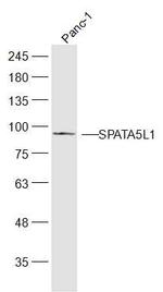 SPATA5L1 Antibody in Western Blot (WB)