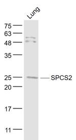 SPCS2 Antibody in Western Blot (WB)