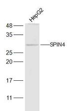 SPIN4 Antibody in Western Blot (WB)