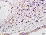FDC-SP Antibody in Immunohistochemistry (Paraffin) (IHC (P))