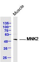 MNK2 Antibody in Western Blot (WB)