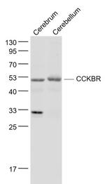 Gastrin receptor/GASR/CCKBR Antibody in Western Blot (WB)