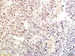 GATA4 Antibody in Immunohistochemistry (Paraffin) (IHC (P))