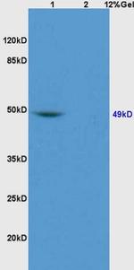 GATA4 Antibody in Western Blot (WB)