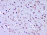 MTHFSD Antibody in Immunohistochemistry (Paraffin) (IHC (P))