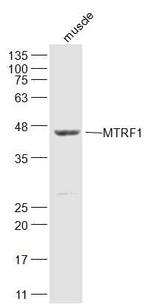 MTRF1 Antibody in Western Blot (WB)