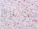 Phospho-STAT6 (Tyr641) Antibody in Immunohistochemistry (Paraffin) (IHC (P))