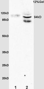 Phospho-STAT6 (Tyr641) Antibody in Western Blot (WB)