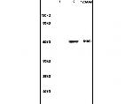 GCK/Glucokinase Antibody in Western Blot (WB)