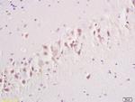 Group I mGLUR Antibody in Immunohistochemistry (Paraffin) (IHC (P))