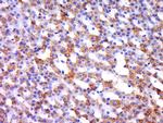 Integrin alpha L/CD11a Antibody in Immunohistochemistry (Paraffin) (IHC (P))