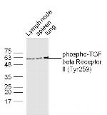 Phospho-TGFBR2 (Tyr259) Antibody in Western Blot (WB)