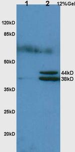 Hpt/Haptoglobin Antibody in Western Blot (WB)