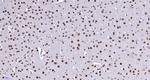 Notch3/4 Antibody in Immunohistochemistry (Paraffin) (IHC (P))