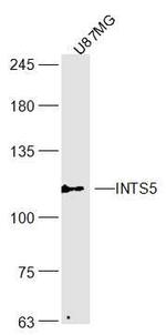 INTS5 Antibody in Western Blot (WB)