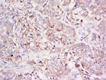 LDLRAD3 Antibody in Immunohistochemistry (Paraffin) (IHC (P))