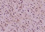Calcitonin Antibody in Immunohistochemistry (Paraffin) (IHC (P))