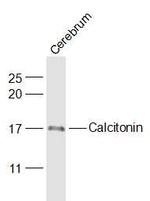 Calcitonin Antibody in Western Blot (WB)