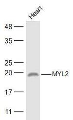 MYL2 Antibody in Western Blot (WB)