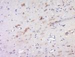 Inhibin Beta C Antibody in Immunohistochemistry (Paraffin) (IHC (P))