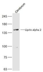 Liprin alpha 2 Antibody in Western Blot (WB)
