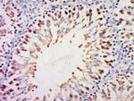 RPS20 Antibody in Immunohistochemistry (Paraffin) (IHC (P))