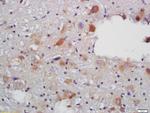 VAT Antibody in Immunohistochemistry (Paraffin) (IHC (P))