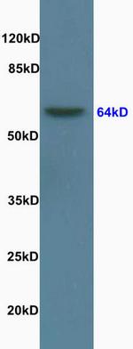 Lamin B1 Antibody in Western Blot (WB)