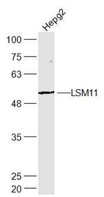 LSM11 Antibody in Western Blot (WB)