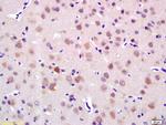 LRIG1 Antibody in Immunohistochemistry (Paraffin) (IHC (P))