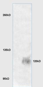 LRIG1 Antibody in Western Blot (WB)